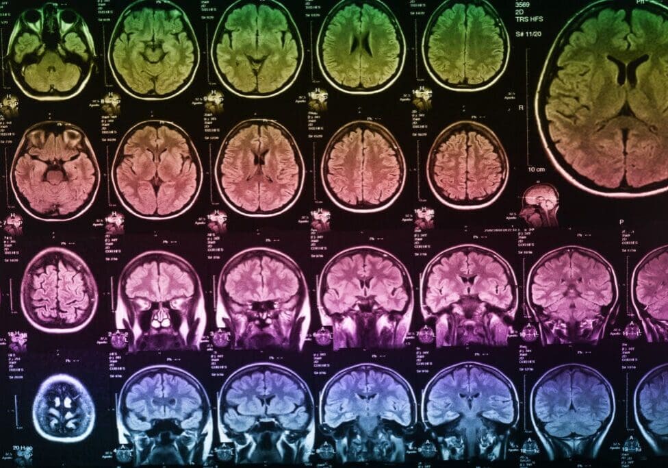 The X-ray of the human brain closeup image