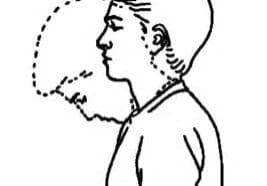 Neck-flexion