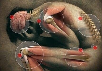 pain-sites